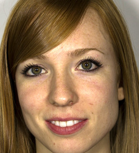 ojeras rojizas